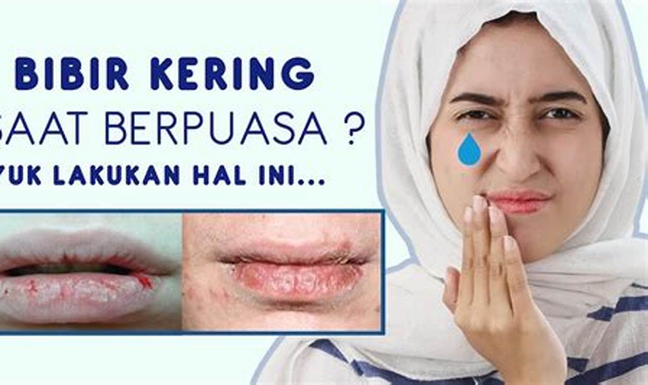 Cara Mengatasi Beser Wanita